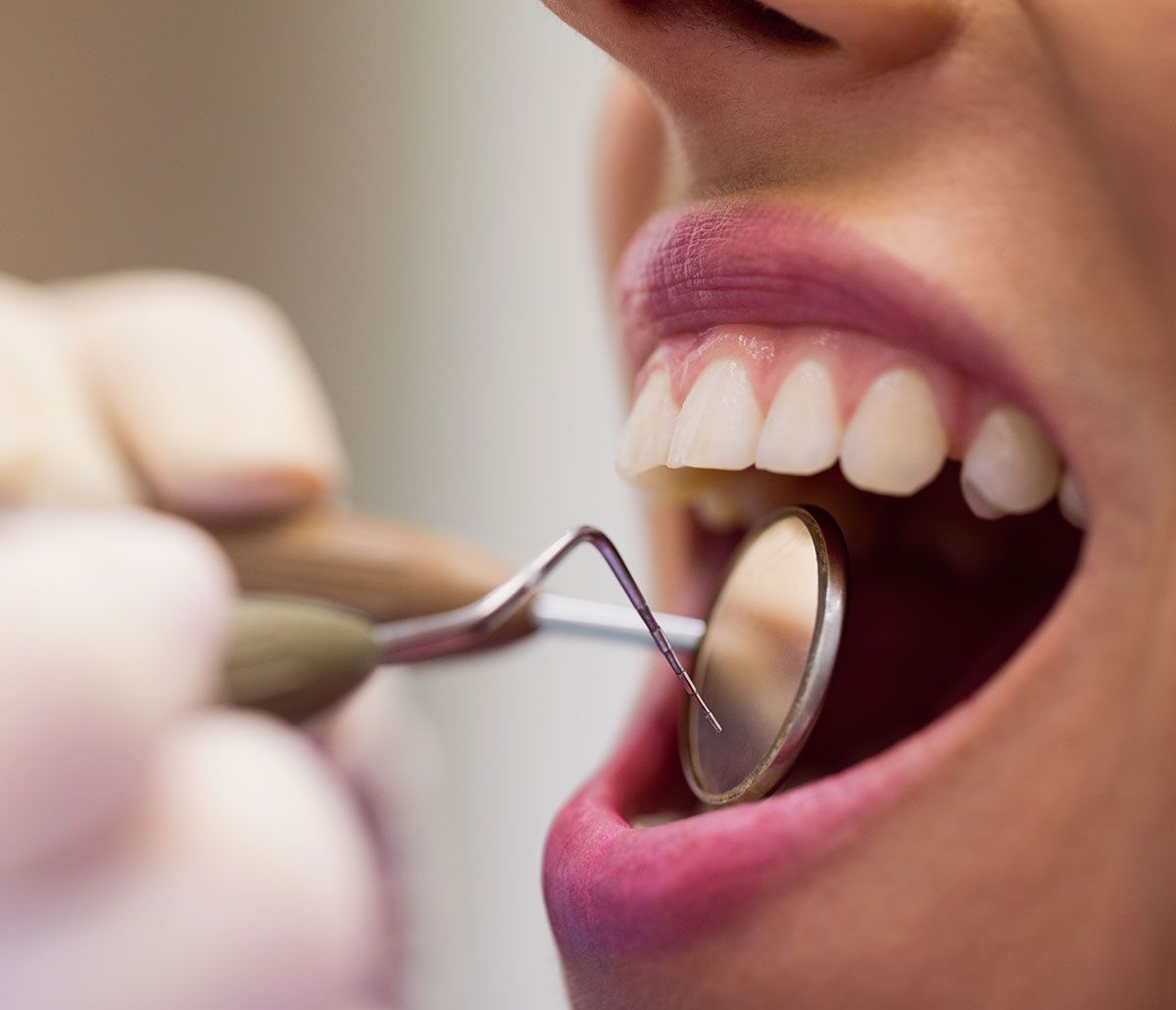 Dental exam mirror